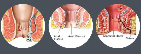 Yalangoch karikatura fotosurati