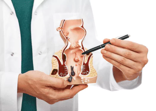 Best Piles Doctor in Pal | Haras Masa Doctor in surat