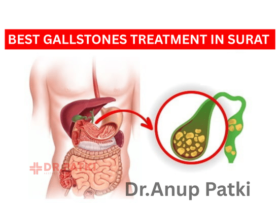 Cost of Gallstones treatment in Surat | Dr. Anup Patki
