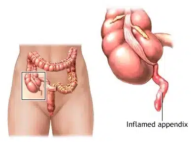 Appendix Operation Cost Kamrej - Dr.Anup Patki