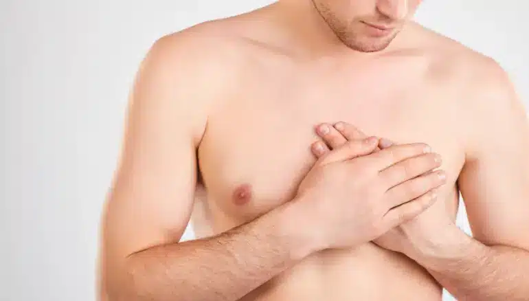 Gynecomastia Specialist in Surat